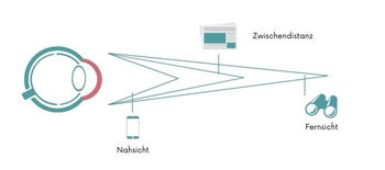 Zu sehen ist ein Augapfel, anhand dessen Sehradius Nah-, Mittel- und Fernsicht erklärt wird
